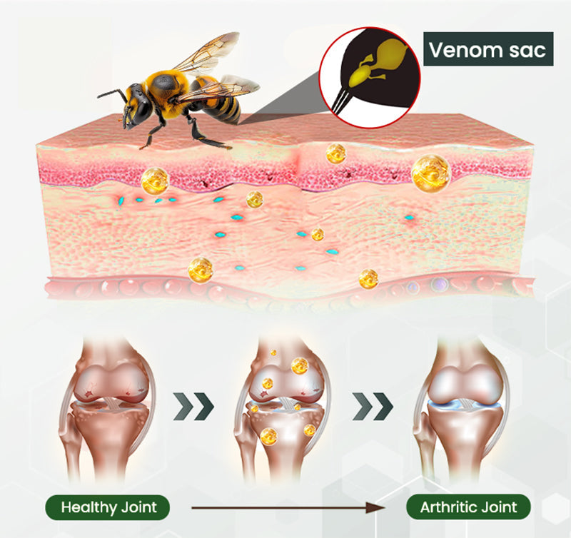 🔥AQA™ Bee Venom Bone & Joint Revive Spray - 60% OFF🔥