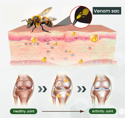 🔥AQA™ Bee Venom Bone & Joint Revive Spray - 60% OFF🔥